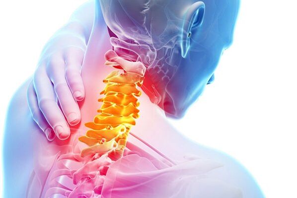 Servikal osteokondrozun nedenleri